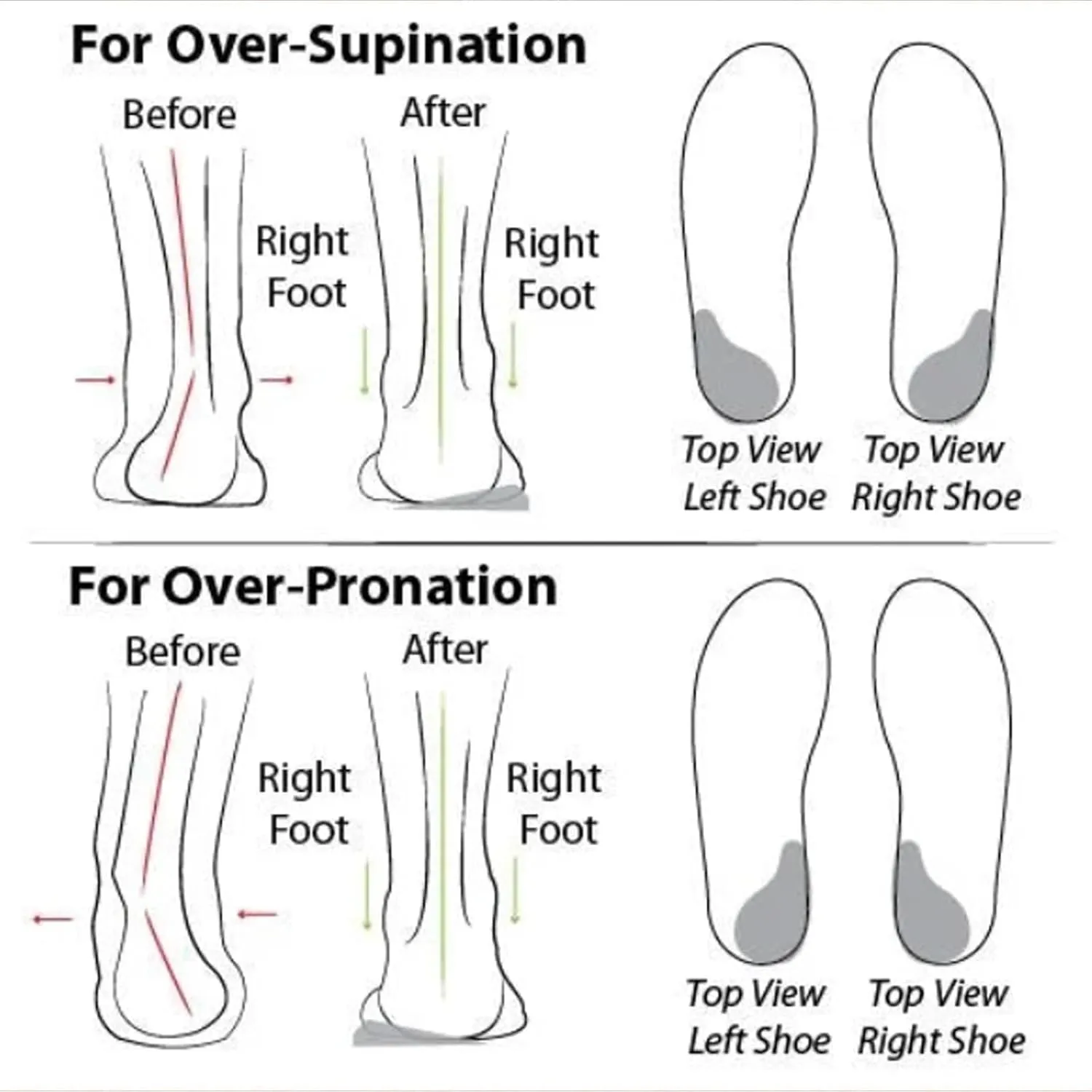 Women's Soft Sole Mesh Comfort Orthopedic Shoes - 2024 New Comfortable Mesh Walking Shoes, Low Top Orthopedic Slip on Shoe for Women, Breathable Arch Support Casual Shoe for Women